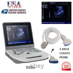 Carejoy Handheld Digital Ultrasound Scanner Diagnostic System&Convex Probe