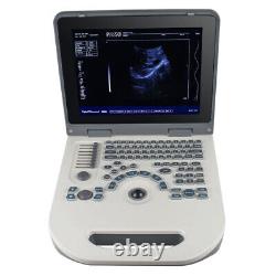 Carejoy Handheld Digital Ultrasound Scanner Diagnostic System&Convex Probe