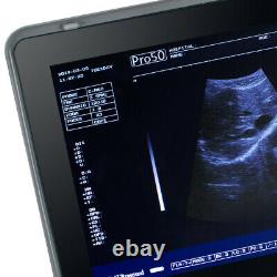 Carejoy Handheld Digital Ultrasound Scanner Diagnostic System&Convex Probe