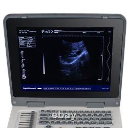 Carejoy Handheld Digital Ultrasound Scanner Diagnostic System&Convex Probe