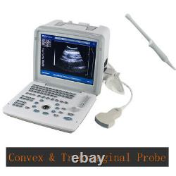 Carejoy Handheld Digital Ultrasound Scanner Machine With Convex&Transvaginal Probe