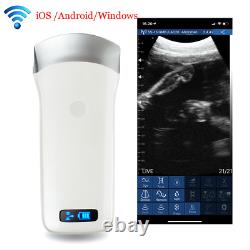 Carejoy Handheld Digital WIFI Wireless Ultrasound Scanner System Convex Probe