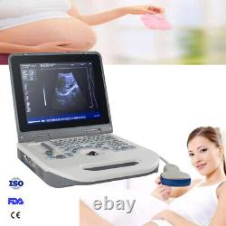 Carejoy Handheld Full Digital Ultrasound Scanner+3.5Mhz Convex Probe