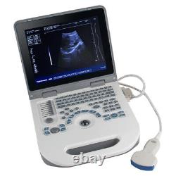 Carejoy Handheld Full Digital Ultrasound Scanner+3.5Mhz Convex Probe