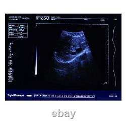 Carejoy Handheld Full Digital Ultrasound Scanner+3.5Mhz Convex Probe