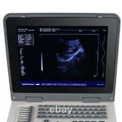 Carejoy Handheld Full Digital Ultrasound Scanner&Diagnostic&Convex Probe