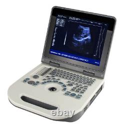 Carejoy Handheld Full Digital Ultrasound Scanner Diagnostic System Convex