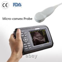 Carejoy Handheld Ultrasound Machine Scanner Digital+Micro-convex Human Use