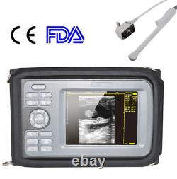 Carejoy Portable Handheld Ultrasound Scanner Digital Transvaginal Probe Human