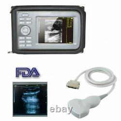 Carejoy Portable Ultrasound Scanner Machine Digital Convex Probe Human CE&FDA