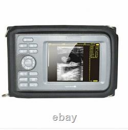 Carejoy Professional Digital Handheld Ultrasound Scanner Machine+Linear Probe