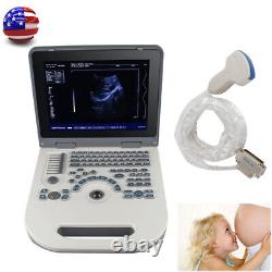 Carejoy Sale Handheld Full Digital Ultrasound Scanner Diagnostic System Convex