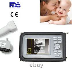 Carejoy USA Digital 5.5'' Handheld Ultrasound Scanner+ Optional Probe For Human