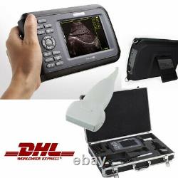 Carejoy USA Digital 5.5'' Handheld Ultrasound Scanner+ Optional Probe For Human