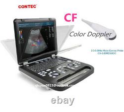 Color Doppler Ultrasound Scanner Cardiac Diagnostic Machine Micro Convex Probe