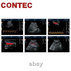 Color Doppler Ultrasound Scanner Cardiac Diagnostic Machine Micro Convex Probe