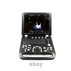 Color Doppler Ultrasound Scanner Cardiac Diagnostic Machine Micro Convex Probe