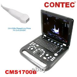 Color Doppler Ultrasound Scanner Cardiac Machine + Phased Array Probe Heart Exam