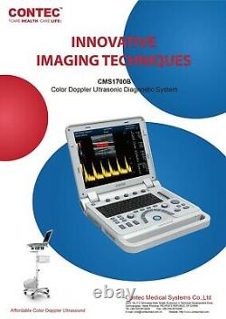 Color Doppler Ultrasound Scanner Cardiac Machine + Phased Array Probe Heart Exam