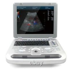 Color Doppler Ultrasound Scanner Cardiac Machine + Phased Array Probe Heart Exam