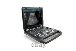 Color Doppler Ultrasound Scanner Cardiac Machine + Phased Array Probe Heart Exam