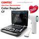 Color Doppler Ultrasound Scanner Portable Laptop Machine 3.5mhz Convex Probe