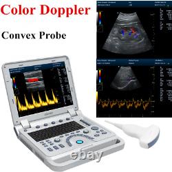 Color Doppler Ultrasound Scanner Portable Laptop Machine Diagnostic Convex Probe