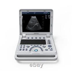 Color Doppler Ultrasound Scanner Portable Laptop Machine Diagnostic Convex Probe