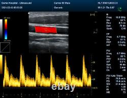 Color Doppler Ultrasound Scanner Portable Laptop Machine Diagnostic Convex Probe