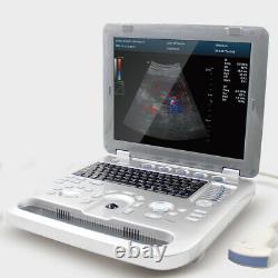 Color Doppler Vascular Ultrasound Scanner with 3.5mhz abdominal probe, Battery