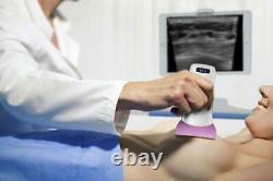 Color Wifi Wireless Ultrasound Scanner Inspect Breast and Hip Bone 256 Elements