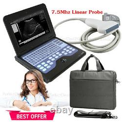 Contec CE Approved Portable Digital Ultrasound Scanner Laptop Machine+Linear