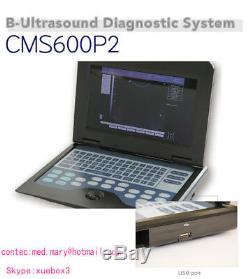 Contec CMS600P2 CE Digital Laptop Ultrasound Scanner Machine CONVEX 3.5Mhz, USA