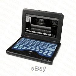 Contec Portable ultrasound scanner laptop machine, 2 probe CMS600P2 Convex/Linear