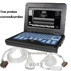 Convex &Cardiac Ultrasound Scanner Diagnostic Portable machine for pregnancy FDA