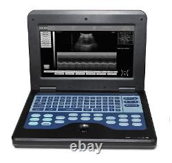 Convex &Cardiac Ultrasound Scanner Diagnostic Portable machine for pregnancy FDA