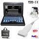 Diagnostic Sonography Portable Ultrasound Scanner Machine+linear Probe Cms600p2