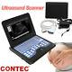Digital B-ultrasound Scanner Portable Machine +convex Abdominal Ultrasound Probe