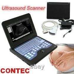 Digital B-Ultrasound Scanner Portable Machine +Convex Abdominal Ultrasound Probe