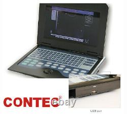 Digital B-Ultrasound Scanner Portable Machine +Convex Abdominal Ultrasound Probe