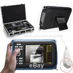 Digital Handheld Palmtop Ultrasound Scanner/Machine Cardiac Micro-Convex ProbeAA