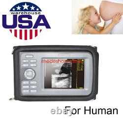 Digital Handheld Ultrasound Scanner Machine Convex Probe LCD Screen Rechargeable