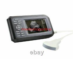 Digital Handheld Ultrasound Scanner Machine Convex Probe LCD Screen Rechargeable