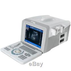 Digital Handheld Ultrasound Scanner Machine with 3.5MHz Convex Probes+ Free 3D