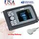 Digital Handscan Handheld Ultrasound Scanner Machine + Convex Probe + Battery Us