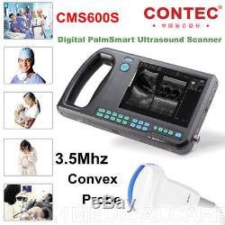 Digital Palmsmart Ultrasound Scanner Handheld Abdominal System, 3.5 Convex Probe