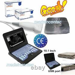 Digital Portable Laptop Ultrasound Scanner Machine 7.5M Linear Probe 600P2 CE