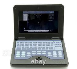 Digital Portable Notebook Laptop Ultrasound machine Scanner system CONVEX PROBE