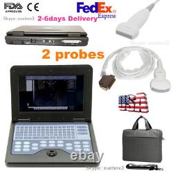 Digital Portable Ultrasound Machine Laptop Scanner + Convex + Linear CMS600P2 US