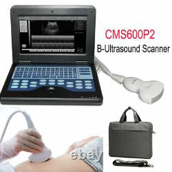 Digital Portable Ultrasound Machine Laptop Scanner with 3.5Mhz Convex Probe CE